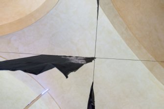 Spazio tra i denti foto 4